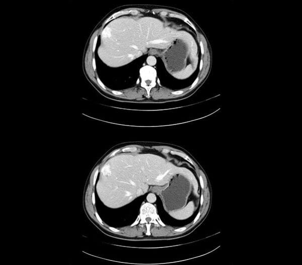 Tomografo computarizado ScintCare CT 16 | 16 & 32 slices - Imagen 4