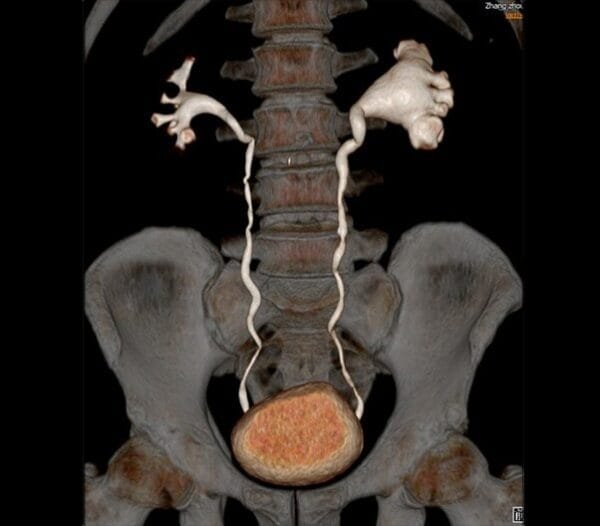 Tomografo computarizado ScintCare CT 16 | 16 & 32 slices - Imagen 7